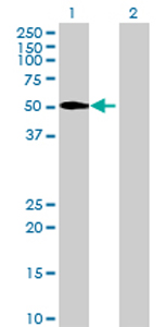 All lanes : Anti-PNLIPRP1 antibody (ab72940) at 1/500 dilutionLane 1 : PNLIPRP1 Transfected 293T cell lysateLane 2 : Non-transfected 293T cell lysateLysates/proteins at 25 µg per lane.SecondaryGoat anti-mouse IgG (H&L)-HRP conjugate at 1/2500 dilution