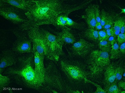 ICC/IF image of ICC/IF staining on miced glia culture cells using ab83178 (1:200). The mixed glia culture was fixed with PFA and the cells were then blocked with 10% donkey serum for 1 hour at 24°C. The cells were then incubated with ab83178 was diluted by 1:200 using 0.3% TritonX with 0.1% PBS and 10% donkey serum. The cells were then incubated with donkey polyclonal to antirabbit conjuaged to Alexa 488 (1:1000). DAPI was used to stain the nucleus.See Abreview