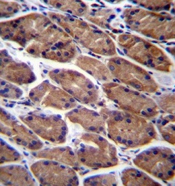 Immunohistochemical analysis of formalin-fixed, paraffin-embedded Human stomach tissue labeling PODNL1 with ab170612 at 1/10 dilution, followed by peroxidase conjugation of the secondary antibody and DAB staining.
