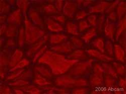 ab10288 at a 1/500 dilution staining human dermal lymphatic endothelial by Immunocytochemistry. The cells were grown in coverslips and fixed in formalin prior to permeabilization with tritonX-100. The cells were incubated with the primary antibody at 1/500 for 1 hour and then bound antibody was detected using a biotinylated goat anti-mouse antibody. Texas red-streptavidin was used for development.This image is courtesy of an Abreview submitted by Maria Navarro.See Abreview