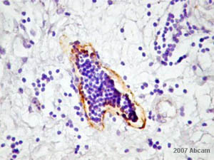 ab10288 at 1/500 dilution staining human thymus specimen tissue sections by IHC-P. The tissue was formaldehyde fixed and a heat induced epitope retrieval step was carried out. The tisse was then blocked and incubated with the antibody. An HRP conjugated rabbit antibody was used as the secondary.See Abreview