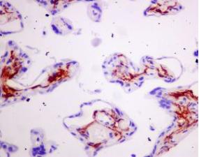 ab128994, at a 1/250 dilution, staining Human Podoplanin / gp36 in pancreas, using Immunohistochemistry, Formalin/PFA-fixed paraffin-embedded tissue.