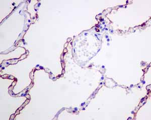 ab128994 showing positive staining in Normal lung tissue.