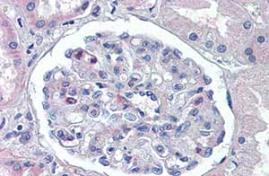 ab104988, at 5ug/ml, staining PODXL in paraffin-embedded Human kidney tissue by Immunohistochemistry.