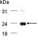 Anti-PODXL antibody (ab26910) at 1/3000 dilution + Podocalyxin like protein fusion protein at 0.4 µg