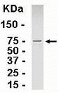 Anti-POLDIP2 antibody (ab26188) at 1/2000 dilution + E coli derived fusion protein 0.5ug.SecondaryGoat anti-IgY-HRP dilution at 1/1000 dilution