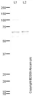 All lanes : Anti-Noradrenaline transporter antibody (ab78190) at 1 µg/mlLane 1 : Brain (Human) Tissue Lysate - adult normal tissue (ab29466)Lane 2 : Spinal Cord (Human) Tissue Lysate - adult normal tissue (ab29188)Lysates/proteins at 10 µg per lane.SecondaryGoat polyclonal to Rabbit IgG - H&L - Pre-Adsorbed (HRP) (ab65484) at 1/3000 dilutiondeveloped using the ECL techniquePerformed under reducing conditions.