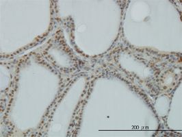 POLR1C antibody (ab56744) used in immunohistochemistry at 3ug/ml on formalin fixed and paraffin embedded human thyroid nodular goiter.