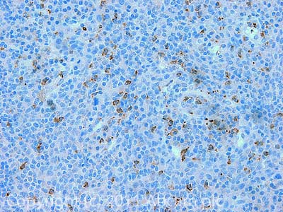 IHC image of ab22770 staining NORE1 in Human Tonsil formalin fixed paraffin embedded tissue section, performed on a Leica BondTM system using the standard protocol F. The section was pre-treated using heat mediated antigen retrieval with EDTA (pH9, epitope retrieval solution 2) for 20 mins. The section was then incubated with ab22770, 5µg/ml, for 15 mins at room temperature and detected using an HRP conjugated compact polymer system. DAB was used as the chromogen. The section was then counterstained with haematoxylin and mounted with DPX.For other IHC staining systems (automated and non-automated) customers should optimize variable parameters such as antigen retrieval conditions, primary antibody concentration and antibody incubation times.