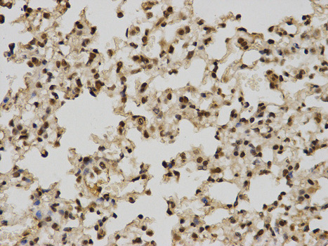 Immunohistochemistry (Formalin/PFA-fixed paraffin-embedded sections) analysis of mouse lung tissue labelling POLR2C with ab186867 at 1/100. Magnification: 400x.