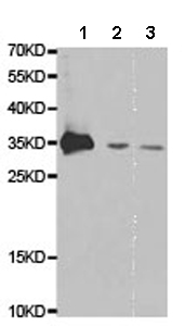All lanes : Anti-POLR2C antibody (ab186867) at 1/500 dilutionLane 1 : SW620 cell lysateLane 2 : OVCAR3 cell lysateLane 3 : Mouse spleen tissue lysate
