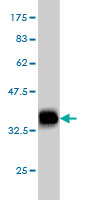 Western blot against tagged recombinant protein immunogen using ab57135 POMT2 antibody at 1ug/ml.