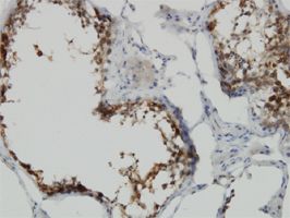 POMZP3 antibody (ab56903) used in immunohistochemistry at 3ug/ml on formalin fixed and paraffin embedded human testis.