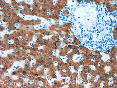 IHC image of ab42322 staining PON3 in Human liver formalin fixed paraffin embedded tissue section, performed on a Leica BondTM system using the standard protocol F. The section was pre-treated using heat mediated antigen retrieval with sodium citrate buffer (pH6, epitope retrieval solution 1) for 20 mins. The section was then incubated with ab42322, 1µg/ml, for 15 mins at room temperature and detected using an HRP conjugated compact polymer system. DAB was used as the chromogen. The section was then counterstained with haematoxylin and mounted with DPX.For other IHC staining systems (automated and non-automated) customers should optimize variable parameters such as antigen retrieval conditions, primary antibody concentration and antibody incubation times.