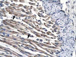 ab22843 staining human muscle tissue sections by IHC-P.  The primary antibody was diluted 4 µg/ml.  Arrows indicate positively labelled skeletal muscle cells.