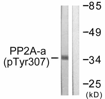 All lanes : Anti-PP2A-alpha (phospho Y307) antibody (ab59222) at 1/500 dilutionLane 1 : A549 cell extractLane 2 : A549 cell extract with immunising peptide