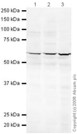 All lanes : Anti-PP5 antibody (ab26053) at 1 µg/mlLane 1 :  HeLa (Human epithelial carcinoma cell line) Whole Cell Lysate Lane 2 : Jurkat (Human T cell lymphoblast-like cell line) Whole Cell Lysate (ab7899)Lane 3 : A431 (Human epithelial carcinoma cell line) Whole Cell Lysate (ab7909)Lysates/proteins at 20 µg per lane.SecondaryGoat polyclonal to Rabbit IgG (Alexa Fluor® 680) at 1/10000 dilution Performed under reducing conditions.