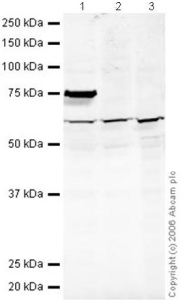 All lanes : Anti-PP5 antibody (ab34693) at 1 µg/mlLane 1 :  HeLa (Human epithelial carcinoma cell line) Whole Cell LysateLane 2 : Jurkat (Human T cell lymphoblast-like cell line) Whole Cell Lysate (ab7899)Lane 3 : A431 (Human epithelial carcinoma cell line) Whole Cell Lysate (ab7909)Lysates/proteins at 20 µg per lane.SecondaryGoat polyclonal to Rabbit IgG (Alexa Fluor® 680) at 1/10000 dilutionPerformed under reducing conditions.