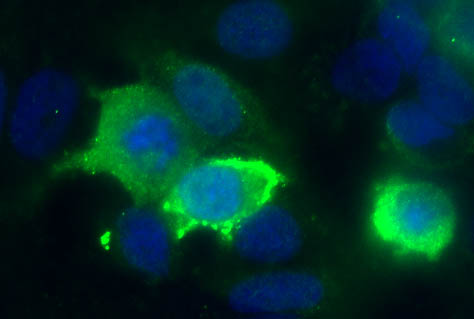 Staining of Human corneal epithelial cells with anti-Notch2 (ab8926, 1/100). The Notch2 (green staining) is localised in the cytoplasm. The nucleus is stained with Bis benzimide (1/500)