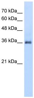 Anti-PPAP2A antibody (ab58745) at 5 µg/ml + HepG2 cell lysate at 10 µgSecondaryHRP conjugated anti-Rabbit IgG at 1/ 50,000 - 1/100,000 dilution.