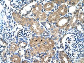 Immunohistochemistry (Formalin/PFA-fixed paraffin-embedded sections) analysis of human kidney tissue labelling PPAP2A with ab58745 at 4-8µg/ml. Arrows indicate positively labelled epithelial cells of the renal tubule. Magnification: 400X.