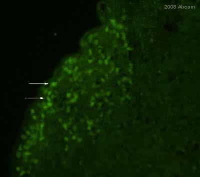 ab23673 staining mouse brain tissue sections by IHC-Fr.  Sections were PFA fixed and permeabilized in Triton X-100 prior to blocking in 10% serum for 1 hour at 25°C.  The primary antibody was diluted 1/200 and incubated with the sample for 48 hours at 4°C.  A FITC conjugated goat anti-rabbit antibody was used as the secondary.See Abreview