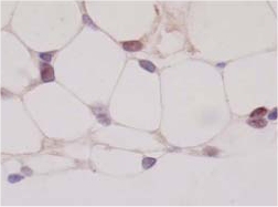 ab41928 staining PPAR gamma 1+2 in rat adiposoe cells (10 ug/mL) by immunohistochemistry, formalin-fixed paraffin embedded sections. 