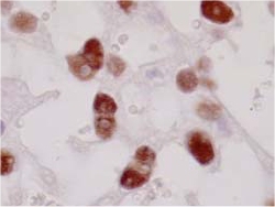 ab41928 staining PPAR gamma 1+2 in rat plancenta(10 ug/mL) by immunohistochemistry, formalin-fixed paraffin embedded sections.