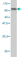 Western blot against tagged recombinant protein immunogen using ab58143 PPEF1 antibody at 1ug/ml.