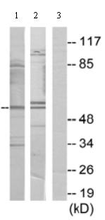 All lanes : Anti-PPHLN1 antibody (ab69569) at 1/500 dilutionLane 1 : Extracts from COLO cellsLane 2 : Extracts from 293 cellsLane 3 : Extracts from COLO cells with immunizing peptide at 10 µgLysates/proteins at 30 µg per lane.