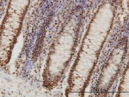 PPIG antibody (ab56485) used in immunohistochemistry at 3ug/ml on formalin fixed and paraffin embedded human colon.
