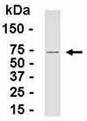 Anti-PPIH antibody (ab37397) at 1/2000 dilution + E coli derived fusion protein at 0.25 µgSecondaryGoat anti IgY HRP at 1/1000 dilutiondeveloped using the ECL technique
