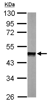 Anti-PPM1A antibody (ab154489) at 1/1000 dilution + Mouse brain whole cell lysate at 50 µg