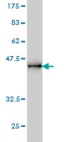Anti-PPM1D antibody (ab56332) at 5 µg/ml + 0.2 µg/lane of partial recombinant protein with a tagSecondaryGoat anti mouse IgG (H&L)-HRP conjugate at 1/5000 dilution