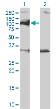 All lanes : Anti-PPM1D antibody (ab56332) at 5 µg/mlLane 1 : 50 µg/lane of transfected 293T cell line lysateLane 2 : 50 µg/lane of non-transfected 293T cell line lysateSecondaryGoat anti mouse IgG (H&L)-HRP conjugate at 1/2500 dilution