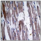 Ab62334 (1/100-1/250) staining human PP1A in human muscle tissue by immunohistochemistry using paraffin embedded tissue.