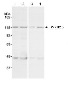 Lanes 1 - 2 : Anti-PPP1R10 antibody (ab70247) at 1 µg/mlLanes 3 - 4 : Anti-PPP1R10 antibody (ab70247) at 0.2 µg/mlLane 1 : Nuclear extract from Hela cells at 15 µgLane 2 : Nuclear extract from Hela cells at 45 µgLane 3 : Nuclear extract from Hela cells at 15 µgLane 4 : Nuclear extract from Hela cells at 45 µg