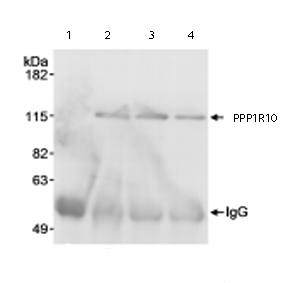 Immunoprecipitation/ Western Blot of PPP1R10 Lane 1: Another antibody which recognizes a different epitope of PPP1R10. Lane 2: Another antibody which recognizes a different epitope of PPP1R10. Lane 3: ab70247 at 1µg/100µg nuclear extract. Lane 4: Another antibody which recognizes a different epitope of PPP1R10. Detection: Chemiluminescence with exposure times of 3 seconds.