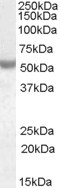 Anti-Nova1 antibody (ab115732) at 0.01 µg/ml + Human breast cancer lysate (in RIPA buffer) at 35 µgdeveloped using the ECL technique