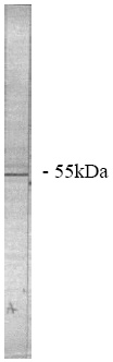 Anti-PPP2R2A antibody (ab28370) (5-10 ug/ml) + Total rat brain homogenate (20-50ug)