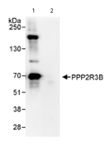 Immunoprecipitation/ Western Blot of PPP2R3B. Lane 1: ab72027 at 3µg/mg whole cell lysate. Lane 2: Control IgG. Whole cell lysate from Hela cells at 1mg for IP, 20% of IP loaded. For western blot detection step ab72027 was used at 1 µg/ml. Chemiluminescence with an exposure time of 30 seconds.
