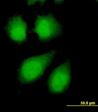 Immunofluorescence analysis of PPP2R4 in HeLa cell using ab67066 at a concentration of 10µg/ml.