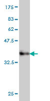 Western blot against tagged recombinant protein immunogen using ab58161 PPP3CB antibody at 1ug/ml.