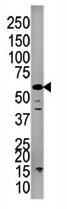 Anti-PPP3CC antibody - Carboxyterminal end (ab71457) at 1/100 dilution + A375 cell line lysate at 12.5 µg