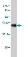 Western blot against tagged recombinant protein immunogen using ab58192 PPP3R2 antibody at 1ug/ml.