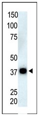 Anti-PPP6C antibody (ab60249) at 1/100 dilution + Thymus cell lysate