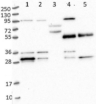 All lanes : Anti-PPTC7 antibody (ab122548) at 1/250 dilutionLane 1 : RT-4 cell lysateLane 2 : U-251 MG cell lysateLane 3 : Human plasma cell lysateLane 4 : Liver cell lysateLane 5 : Tonsil cell lysate