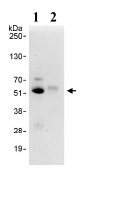 Detection of PRAK in Immunoprecipitates of Whole cell lysate from HeLa cells (1 mg for IP, 20% of IP loaded) using ab93800 at 3 µg/mg lysate for IP (Lane 1) and at 1 µg/ml for subsequent Western blot detection. Lane 2 represents control IgG IP. Detection: Chemiluminescence with an exposure time of 10 seconds.