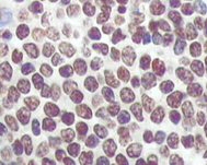 Immunohistochemical analysis of paraffin-embedded human normal spleen tissue using ab66382 at a dilution of 1/500 - 1/2000 with DAB staining, showing nuclear/cytoplasmic localization.