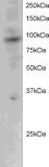 staining (2µg/ml) of Jurkat lysate (RIPA buffer, 30µg total protein per lane). Primary incubated for 12 hours. Detected by western blot using chemiluminescence